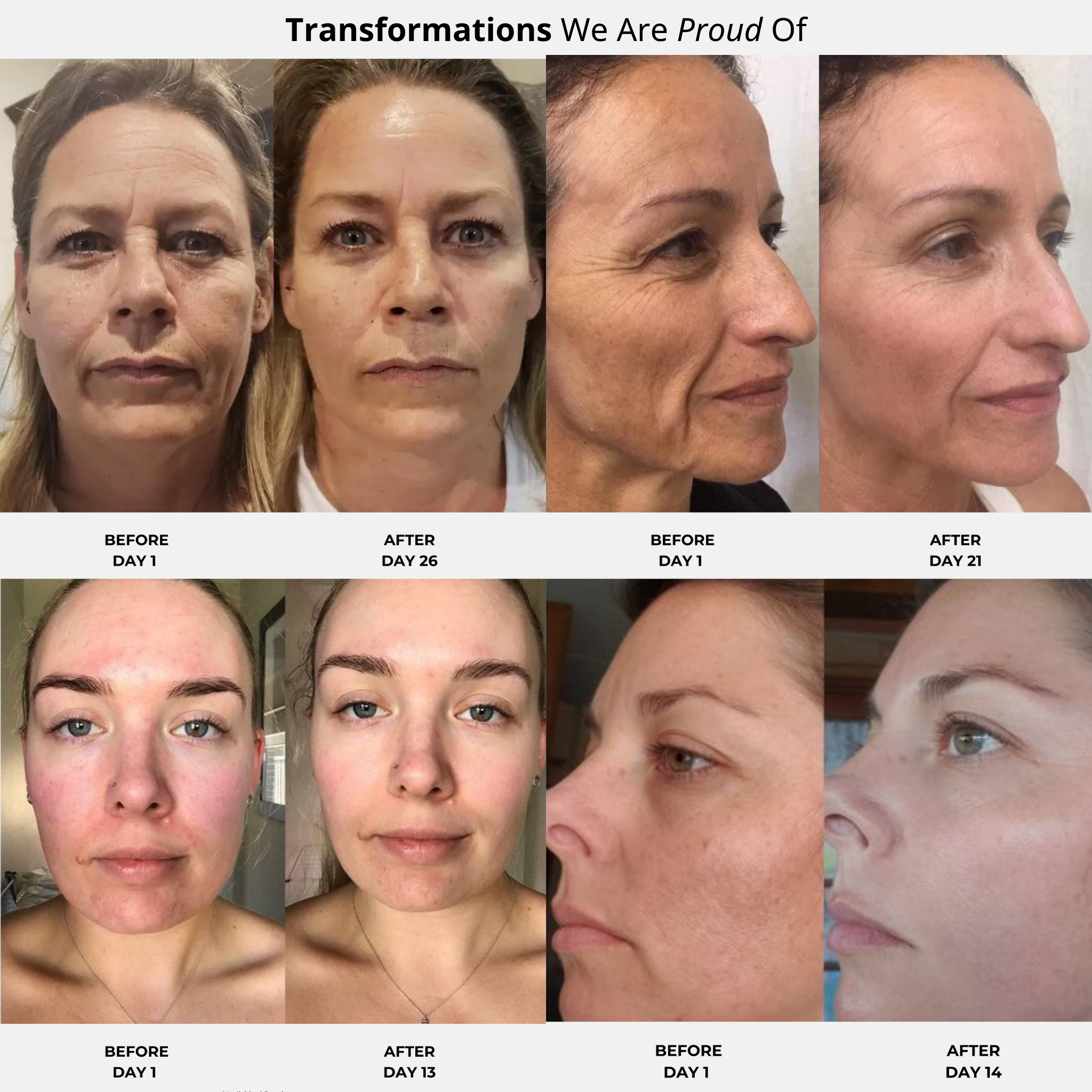 ANTI-AGING TRANSFORMATION KIT.